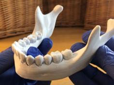 Loose Teeth 3D Printer Model