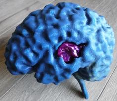 MRI Brain 3D Printer Model