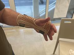 Parametric Wrist Orthesis 3D Printer Model