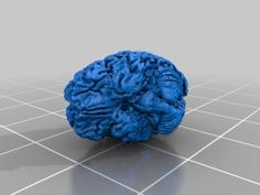 35 Year Old’s Brain 3D Printer Model